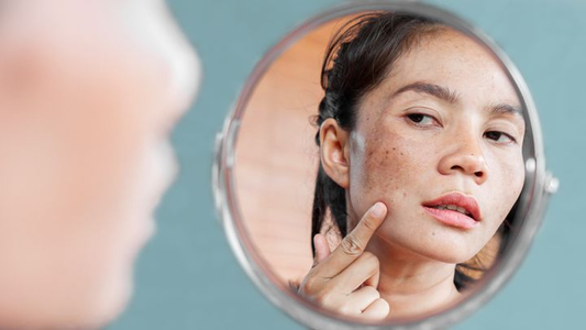 The Top Ingredients That Get Rid Of Hyperpigmentation